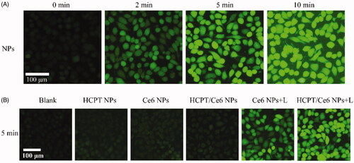 Figure 3. The representative fluorescent microcopy images of intracellular singlet oxygen generation by DCFH-DA in 4T1 cells incubated with HCPT/Ce6 NPs (with laser) for different laser irradiation times (A) and incubated with different formulations (B). Scar bar: 100 µm.