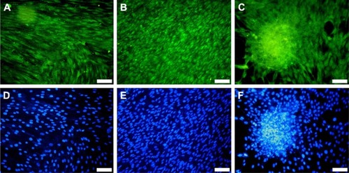 Figure 14 Immunofluorescence for CD90 expression in mesenchymal stem cells.Notes: Cells grown on Ti-uncoated (control) (A, D) and coated with BG-O (B, E), and BG-5S (C, F) films. CD90 stained green with CruzFluor 488 (A–C); nuclei counterstained blue with DAPI (D–F). Objective 20×; magnification bar 50 μm.Abbreviations: Ti, titanium; BG-O, films deposited from the simple BG target; BG-5S, films deposited from BG target with five silica plates.