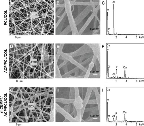 Figure 4 The morphology and elemental composition of scaffolds.Notes: (A) SEM image of PCL/COL with interconnected pores; (B) higher magnification SEM image exhibited smooth surface; (C) EDX results suggested no Ca and P present; (D) ACP/PCL/COL with a rough surface and a diameter of about 200 nm; (E) higher magnification SEM image shows the surface roughness of the fibers; (F) the peaks of Ca and P suggested the presence of ACP. (G) rhCEMP1/ACP/PCL/COL scaffolds with (H) higher magnification SEM image to show the surface roughness of the fibers; and (I) the peaks of Ca and P suggested the presence of rhCEMP1/ACP.Abbreviations: ACP, amorphous calcium phosphate; COL, type I collagen; EDX, energy-dispersive X-ray spectroscopy; PCL, poly(ε-caprolactone); rhCEMP1, recombinant human cementum protein 1; SEM, scanning electron microscopy.