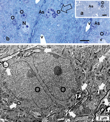 Figure 16. Interfibrillar oligodendrocytes (O) of ODS48h murine thalamus. A-B: examples of mitotic cells (open arrows); A: in myelinolytic zone and B: in periphery of myelinolysis epicenter. Scales equal 5µm. C: TEM aspect of twin oligodendrocytes, resulting from mitosis amongst the repairing neuropil. Poor myelination wrappings and some blemishes from myelinolysis are marked by white arrows. As: Astrocyte, v: blood vessel; * : examples of wide neuropil spaces caused by myelinolysis