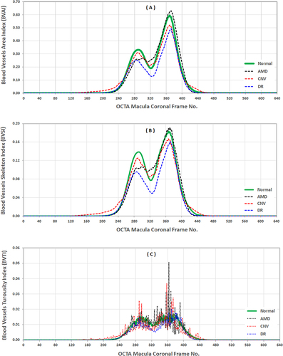 Figure 5 The resulting BVAI, BVSI, and BVTI OCTA graphs of the 90 normal, 5 AMD, 5 CNV, and 29 DR subjects derived from original OCTA B-Scans, the OCTA BVAI graph (A), the OCTA BVSI graph (B), the OCTA BVTI graph (C).