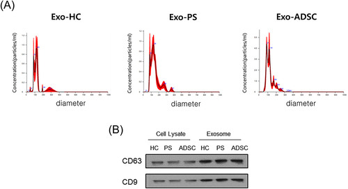 Figure 2 Characterization of exosomes (A) Results of nanoparticle tracking analysis demonstrating a similar size distribution in separated exosomes from healthy control serum or psoriasis patient serum or ADSCs (n = 4). (B) The representative exosome markers CD63 and CD9 were detected by Western blotting (n = 3).