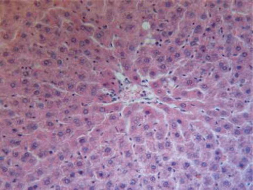 FIGURE B3. Liver of trapidil group showing mild degeneration of hepatic cells (H&E, ×200).