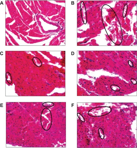 Figure 6 Typical images of pathological classification of myocardium injury of different DOX formulations: (A) NS; (B) DOX solution; (C) NH4EDTA-L (low-dose); (D) NH4EDTA-L (medium-dose); (E) NH4EDTA-L (high-dose); and (F) (NH4)2SO4-L.Notes: Photographs were obtained under a fluorescence microscope (IX71; Olympus Corporation, Tokyo, Japan) using a 40× objective. The black circles point out the damaged sites of myocardium fragmentation.Abbreviations: DOX, doxorubicin; EDTA, ethylenediaminetetraacetic acid; L, doxorubicin-loaded liposomes; NS, normal saline.
