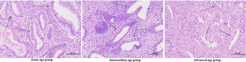 Figure 1 Hematoxylin and eosin staining in human endometrium. The uterine histology detected by Hematoxylin and eosin staining. The uterine glands were very coiled with wide lumens in premenopausal women. However, subjects over the age of 50 years (almost postmenopausal women) were noted to have atrophy of the uterine glands. The arrows indicate the uterine glands.