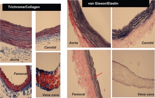 Figure 3 A Masson trichrome blue staining. The blue color represents collagen. The aorta and carotid artery showed minimum levels of collagen expression, whereas a higher level of collagen was present in the femoral artery and in the vena cava. Van Gieson staining was used to stain different blood vessels to determine the presence of elastin, which is represented by the blackish-brown color. The aorta and carotid artery showed higher levels of elastin in comparison with the femoral artery and the vena cava. The red arrow indicates the broken structure of the elastin tissue; the underlying cause of this could be the higher level of expression of the MMP-9 protein (an elastinase) in the femoral artery in comparison with the other blood vessels.