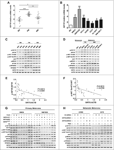 Figure 6. SIRT6 inhibited IGF-AKT signaling in melanoma. (A and B) qRT-PCR analysis of IGF1R mRNA level in melanoma tissues and cell lines. Data are presented as means ± SD. *, P < 0.05; **, P < 0.01; ***, P < 0.001, BN and MC as control, respectively. (C and D) Immunoblotting analysis showing the expressions of IGF-AKT signaling-related proteins in melanoma tissues and cell lines at different stages. BN as control in (C), MCs as control in (D). The ‘p-’ prefix indicates the phosphorylated form. (E and F) Spearman's correlation test of immunoblotting densitometry analysis between SIRT6 and the ratio of p-IGF1R:IGF1R or p-AKT:AKT in melanoma tissues at different stages and benign nevus tissues. (n = 30, 10 per group.) (G and H) Representative immunoblotting analysis showing the expression of IGF-AKT signaling-related proteins in melanoma cells with different treatments as indicated. For (A and B), Students' t test was used to calculate the P value.