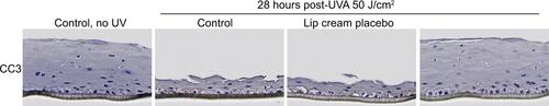 Figure S2 Lip cream with UV filters inhibited UVA-induced apoptosis (CC3, brown staining) in EpiGingival™ at 28 hours post-UVA (50 J/cm2) after UVA irradiation.Notes: Lip cream placebo is the test formulation without the UV filters. Untreated samples were not applied with any test product (n=3).Abbreviations: CC3, cleaved caspase-3; UVA, ultraviolet A.