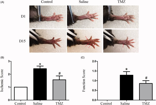 Figure 1. TMZ attenuates ischaemic injury in hindlimb of diabetic mice. (A) Representative photographs of hindlimbs from mice with sham surgery (control group, n = 10), untreated mice after FAL (saline group, n = 10), and TMZ-treated mice after FAL (TMZ group, n = 10) were shown; (B) The severity of the lesion in ischaemic hindlimb was estimated according to a five-point scoring system; (C) The foot function score of the ischaemic hindlimb was estimated. Results are expressed as mean ± SEM. *p < .05 compared to the control group, #p < .05 compared to the saline group.