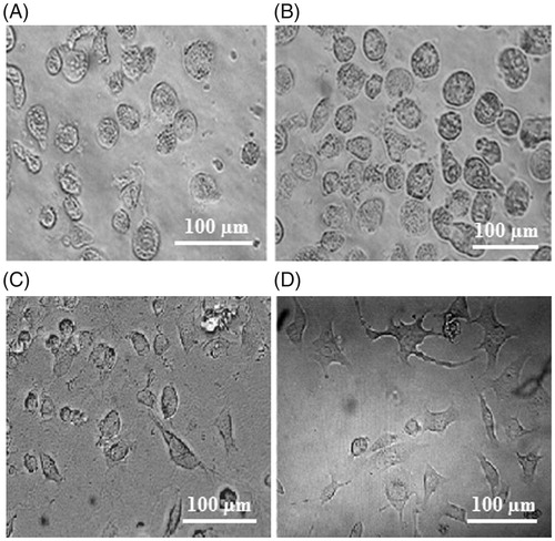 Figure 3. Morphology of cells cultured on (A) soft, (B) medium and (C) hard polyacrylamide substrates after 24 h, and (D) hard substrate after 48 h. Experiments were performed in triplicate.
