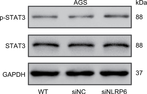 Figure S4 Effects of NLRP6 knockdown on STAT3 phosphorylation.Notes: Blots are representative of three separate experiments. WT, wild-type cells; siNC, negative control siRNA.