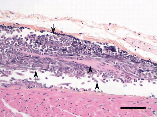 Figure 2.  Aggregation of microfilariae (arrows) in a vein of the pericardium of an emaciated boreal owl. Some microfilariae are embedded in a fibrinoid material (arrowhead). Scale bar = 50 µm; haematoxylin phloxine saffron.