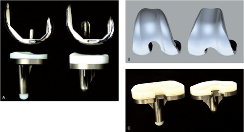 Figure 1. A. Sagittal view of the PFC design (left) and the CKS design (right). B. Anterior view of a computer model of the femoral components. Notice the lateral orientation of the trochlea in PFC (left) and neutral orientation in the CKS component (right). C. Posterior view of the tibial and PE insert components. The central posterior edge of the CKS insert (right) is relatively sharp compared to the PFC insert (left).