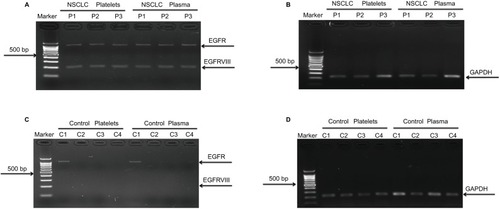 Figure 4 EGFRvIII expression in platelets and plasma derived from NSCLC patients.Notes: (A) EGFRvIII expression in 3 NSCLC platelets and plasma. (B) GAPDH expression as positive control in patients’ platelets and plasma, three controls’ results are shown here as an example. (C) No EGFRvIII expression in 50 healthy controls, and four individuals’ results are shown here as an example. (D) GAPDH expression as positive control in healthy individuals’ platelets and plasma. Four individuals’ results are shown here as an example.Abbreviations: EGFR, epidermal growth factor receptor; NSCLC, non-small-cell lung cancer.