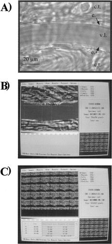 Figure 1. A View of a rat mesenteric arteriole in basal conditions. c.t.: connective tissue; e.: endothelium; v.l.: vascular lumen. B) View of a digitized image of a mesenteric arteriole during the early step of determination of the diameter with Morphostar software. The arteriolar lumen is colored in red and the cursors used to calculate the arteriolar diameter are aligned with the vessel edges. C) View of 30 digitized images of a mesenteric arteriole during the last step of calculation of the diameter. Examples of the results of calculation are given in the table in the lefthand corner of the picture.