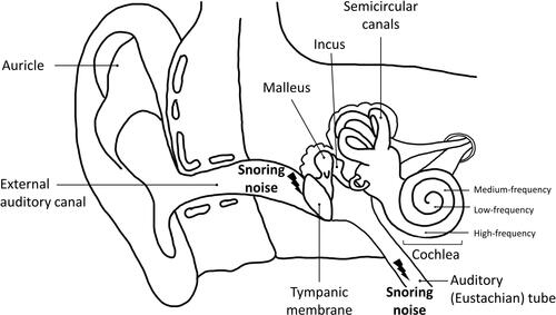 Figure 3 Different parts of the cochlea corresponding to different frequencies. High-frequency hearing in the cochlear basal turn is exposed and vulnerable to the snoring noise.