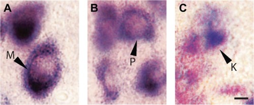 Figure 5 LGN cell types can be differentiated according to pattern of staining for VGLUT2 mRNA. A) M cells are large and exhibit strong nuclear staining for VGLUT2 mRNA. B) P cells are slightly smaller but also show intense staining for VGLUT2. C) K cells are the smallest of all three and show weak, diffuse staining for VGLUT2. Scale bar is 50 µm.