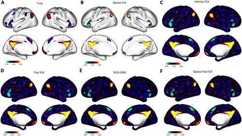 Fig. 3 The true and estimated IC-2 (Default Mode Network A) from a single repetition. A: The true IC-2. B: Sparse ICA. C: Infomax ICA. D: Fast ICA. D: SICA-EBM. F: Sparse Fast ICA.