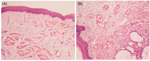 Figure 11. Microphotographs of mucosal tissue samples from the histological safety evaluation, (A) control group received physiological saline after 7 days of administration, (B) test group received TNZ-loaded in situ gel forming system after 7 days of administration.
