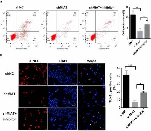 Figure 6. MIAT can regulate the apoptosis of BMSCs by targeting miR-150-5p. TUNEL staining (a and b) and flow cytometry (c and d) showed that compared with shNC group, the cell apoptosis of BMSCs was significantly decreased in shMIAT group, which was reversed by miR-150-5p inhibitor. *p < 0.05, **p < 0.01, ***p < 0.001. Note: The scale length is 50 μm.