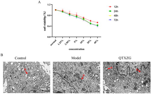 Figure 9. Effect of QTXZG on mitochondrial damage and autophagy activity in glomerular podocytes. (A). line graph of screening for optimal QTXZG serum concentration and timing. (B). Transmission electron microscopy (20000 ×) images of cell ultrastructure. a. mitochondria; b. autophagosome.