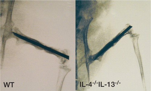 Figure 1. Faxitron image of fracture specimens, stabilized by intramedullary nail, at killing 5 weeks postoperatively. WT animal (left) and IL‐4-/-IL‐13-/‐animal (right).