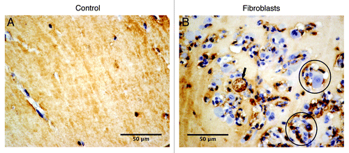 Figure 4. Cellular phenotypes colonizing matrigel plugs after one week of implantation. Representative images for CD31 staining: (A) matrigel implanted without fibroblasts (control) and (B) matrigel implanted with fibroblasts, arrow pointing out the CD31-positive cells and circular structures indicating the microvessels.