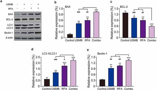Figure 3. Western blot analysis of the effects of combination therapy of USMB and RFA on apoptosis- and autophagy-related proteins in Panc02 cells. (a) Representative western blot image and protein expression level of (b) BAX, (c) BCL-2, (d) LC3 II/LC3 I, and (e) Beclin-1. *p < 0.05, **p < 0.01 and ***p < 0.001 vs. Control group; #p < 0.05, ##p < 0.01 and ###p < 0.001 vs. Combo group. Results were showed as means ± SD (n = 6)