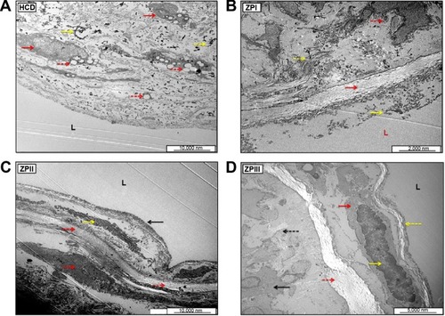 Figure 19 Ultrastructural electron micrographs of aortic endothelial cells from the HCD (A), ZPI (B), ZPII (C), and ZPIII (D) groups.