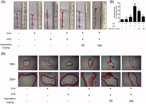 Figure 1. Kaempferol reduced atherosclerotic lesion size and lesion lipid deposition in mice. Atherosclerotic lesion formation detected by red oil O staining (A); the quantitative data of Oil Red staining (B); Atherosclerotic lesion formation detected by HE staining (C) (n = 5).