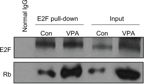 Figure 5 Valproic acid influences retinoblastoma protein, E2F-1, and retinoblastoma protein-E2F complex. Detection of E2F and retinoblastoma protein binding by the protein complex immunoprecipitation method in mice after treatment with valproic acid for two weeks.