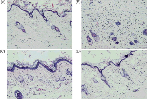 Figure 5. Anti-inflammatory activity of TNF30 in vivo in a carrageenan-induced mice paw oedema experiment. Histopathological analysis of normal mice (A) and inflammatory mice treated with PBS (B), TNF30 at 30 mg/kg (C) or TNF30 at 60 mg/kg (D).