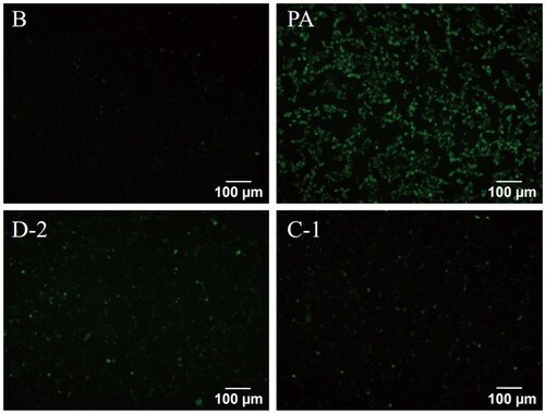 Figure 3. Compounds D-2 and C-1 reduced ROS generation in PA-induced Min6 cells. Min6 β cell were incubated with D-2 and C-1 at concentration of 10 μmol/L and then exposed to PA (300 μmol/L) for 8 h. Immunofluorescence staining for ROS was photographed by fluorescence microscopy. Bar: 100 μm.