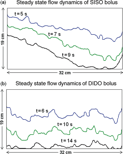 Figure 10. Propagation of isothermal contour on the bolus surface for a step change in the circulating water temperature captured for the (A) SISO and (B) prototype DIDO water boluses at steady state fluid flow and 2 L/min flow rate.