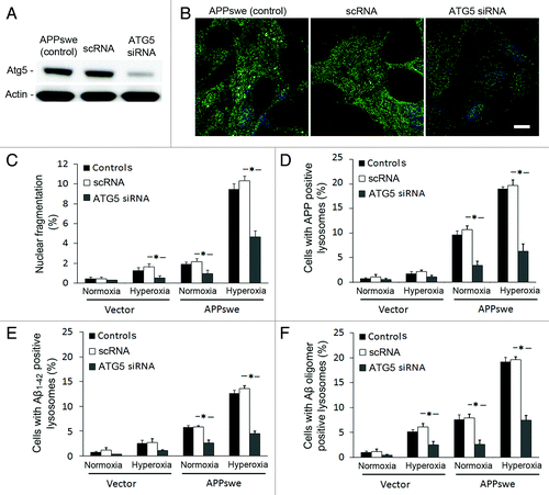 Figure 9. Downregulation of ATG5 by siRNA protected cells from apoptosis and decreased the intralysosomal accumulation of APP and Aβ. (A) Western blot of ATG5 in APPswe cells (control), cells with scramble RNA transfection (scRNA) or ATG5 siRNA transfection. (B) Single immunostaining of LC3 (green fluorescence) in APPswe cells (control), cells with scRNA, and with ATG5 siRNA after 3 d exposure to hyperoxia. Both control and scRNA cells showed brighter and more granular staining of LC3 compared with ATG5 siRNA cells. Bar, 40 μm. (n = 3). Nuclei were stained by DAPI (blue fluorescence). (C–F) Vector and APPswe cells (controls), cells with scRNA, or ATG5 siRNA were exposed to normoxia and hyperoxia for 3 d. The number of cells with: nuclear fragmentation (C) and with APP (D), Aβ1–42 (E), or Aβ oligomer (F) -positive lysosomes were counted. ATG5 siRNA protected cells from death (C), and decreased lysosomal accumulation of APP (D), Aβ1–42 (E), and Aβ oligomers (F) (*p < 0.05; n = 3).