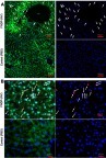 Figure 2 Fluorescence microscopy images of paraffin sections (5 µm) of liver obtained from rats treated or not with FNDP-(NV).Notes: (A) Images of tissue sections analyzed with 10x objective with 1.6x extension. (B) Images of tissue sections analyzed with oil 40x objective. Left images show overlapped three colors: red (FNDP-(NV)), blue (DAPI-nuclei), green (phalloidin –cytoskeleton). Right images accordingly show overlapped two colors: red (FNDP-(NV)), blue (DAPI-nuclei). Upper images in each panel represent FNDP-(NV)-treated rats, lower images in each panel control (PBS-treated rats). Areas occupied by the particles are indicated by white arrows.Abbreviations: FNDP-(NV), fluorescence nanodiamond particles with NV active centers; PBS, phosphate-buffered saline; FITC, fluorescein isothiocyanate; DAPI, 4ʹ,6-diamidino-2-phenylindole; PV, portal vein; CV, central vein; BD, bile duct.