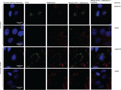 Figure 5 Receptor-specific internalization of FGF1V or FGF1V-AuNPs visualized with confocal fluorescence microscopy.Notes: U20S R1 and U20S cells were incubated with fluorescently labeled FGF1V-AuNPs (FITC, FGF1V-AuNPs), and fluorescently labeled FGF1V (FITC, FGF1V). AuNPs were detected with confocal reflectance and cell nuclei were visualized with Hoechst staining. Only cells expressing FGF receptor internalized conjugates.Abbreviations: FGF1V, fibroblast growth factor 1 variant; AuNPs, gold nanoparticles; FITC, fluorescein isothiocyanate.