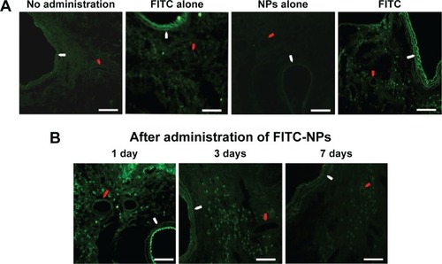 Figure 2 Biodistribution of FITC-NPs in the lung after a single instillation.Notes: (A) Representative fluorescent micrographs of rat lung tissue treated with instillations of FITC-NPs, FITC alone, and NPs alone, and the no-administration group, 1 day after a single instillation. (B) Representative fluorescent micrographs of the localization of FITC on days 1, 3, and 7 after a single instillation of FITC-NPs. White arrows indicate bronchia, and red arrows indicate the small arterioles. Scale bars 100 μm.Abbreviations: FITC-NPs, fluorescein isothiocyanate nanoparticles; FITC, fluorescein isothiocyanate; NPs, nanoparticles.