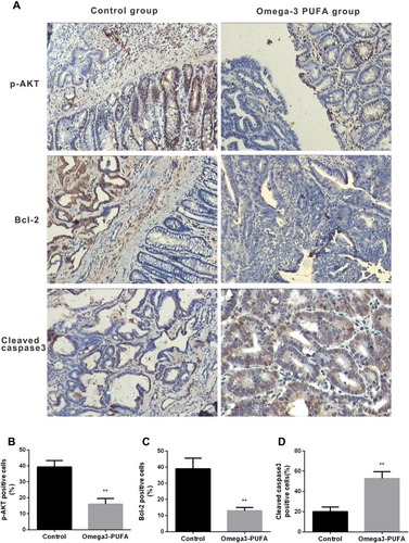 Figure 2 Omega-3 PUFA inhibits AKT/Bcl-2 signaling in MNU-induced colorectal cancer rats. Rats in the Omega-3PUFA intervention group were intragastrically given Omega-3PUFA (2 g.kg−1) once a day for 4 weeks (the control groups of rats were given the same amount of normal saline instead of Omega-3PUFA). (A) The protein levels of p-AKT, Bcl-2 and cleaved caspase3 in the tumor tissues of the two groups (Omega-3PUFA group and control group) were detected by immunohistochemistry. Representative micrographs from 6 mice per group are shown, Scale bar=200 μm. (B-D) Quantitative analysis of protein levels of p-AKT (B), Bcl-2 (C) and cleaved caspase3 (D) in tumor tissues of the two groups. Unpaired 2-tailed t test. **P < 0.01. Bar graphs represent the mean ± SD for B, C and D.