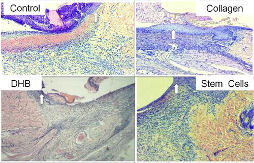 Figure 5 The wound edges in different groups on the 7th day of the study. Hematoxylin–eosin staining, magnification x100. The arrows indicate the newly formed epithelium, which was wider and contained more layers in the SC and Collagen groups than that in the Control and DHB groups. In the SC and Collagen groups, the epithelium was multilayered, creeping from the edge to the center, and gradually becoming thinner. In the DHB and Control groups, there were signs of initial marginal epithelialization (a short section of a 1-2 layered epithelium, which starts creeping from the wound edge).