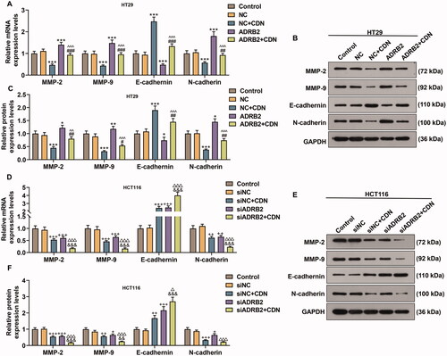 Figure 6. CDN lessened MMP-2, MMP-9 and N-cadherin expression but augmented E-cadherin expression in CRC cells through inhibiting ADRB2 expression. (A–F) ADRB2 overexpression or knockdown was achieved by transfection of ADRB2 overexpression plasmid or siADRB2 into CRC cells, respectively. Transfected cells were exposed to CDN and then examined for the mRNA and protein levels of MMP-2, MMP-9, E-cadherin and N-cadherin using RT-qPCR (A, D) and Western blotting (B, C, E and F). GAPDH acted as the internal control. ***p < 0.001 vs. NC; ##p < 0.01 or ###p < 0.001 vs. NC + CDN; ^^p < 0.05 or ^^^p < 0.001 vs. ADRB2; +p < 0.05 or ++p < 0.01 or +++p < 0.001 vs. siNC; &&p < 0.05 or &&&p < 0.001 vs. NC + CDN-10; △△△p < 0.001 vs. siADRB2. NC: negative control (empty vector); siNC: negative control of small interfering RNA (siRNA); CDN: cardamonin; CRC: colorectal cancer; ADRB2: β2 adrenergic receptor; RT-qPCR: reverse transcription-quantitative polymerase chain reaction; MMP: matrix metalloprotease; siADRB2: small interfering RNA for ADRB2.