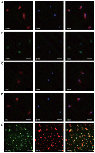 Figure 1. Identifying the characteristics of rat spleen-derived endothelial progenitor cells (EPCs). (A–D) Representative images of the markers on rat spleen-derived EPCs. (A) for CD34 (red); (B) for CD31 (green); (C) for vWF (red); (D) for Flk1 (red). Scale bar: 25 μm. (E) Representative images of EPCs uptake of DiI-acLDL and binding of FITC-UEA-1. Scale bar: 100 μm.