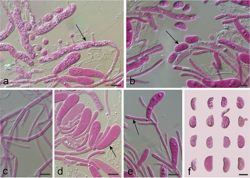 Figure 37. Microscopic structures of Helicogloea hangzhouensis (holotype). (a,b) A vertical section of hymenium [basidia indicated by an arrow in (a) and basidiospores indicated by an arrow in (b)]. (c) Hyphae. (d) Probasidia indicated by an arrow. (e) Hyphidia indicated by an arrow. (f) Basidiospores. Scale bars: 10 μm.
