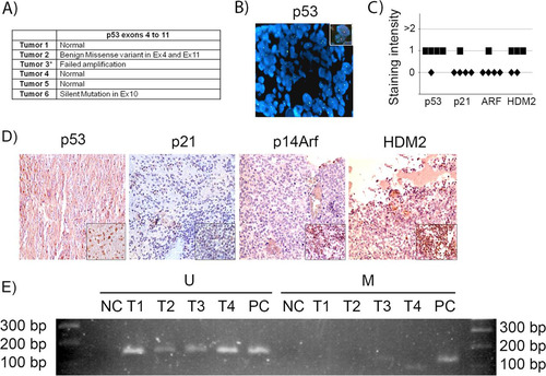 FIG 8 p53 gene and pathway likely are not active in human sPNET. (A) Results of sequencing of p53 exons 4 to 11 in 6 human sPNET samples. (B) FISH staining for p53 gene deletion in tumor 3. The inset shows a positive control. (C) Quantitation of the intensity of expression of p53, p21CIP1, p14ARF, and HDM2, detected by immunohistochemistry, in sPNET samples. (D) Representative images of immunostaining for the indicated proteins in human sPNET samples. The insets represent the respective positive controls. (E) Analysis of p14Arf promoter methylation status in sPNET samples (T1, T2, T3, and T4), showing unmethylated (U) and methylated (M) sequences. NC, negative control; PC, positive control.