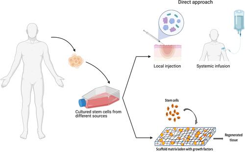 Figure 5 Different modes of delivery of stem cells/secretome for burn wounds. Stem cells and their products can be delivered onto burn wounds either as direct local injection, delivered in a supportive matrix such as fibrin or embedded with in scaffold matrices. Such approaches improve sustained delivery of therapeutics factors and/or maintain cell viability.