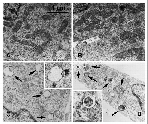 Figure 4. SIRT5 silencing or inhibition induces autophagy. MDA-MB-231 WT cells, either treated with MC3482 or left untreated, as well as SIRT5+ and SIRT5- cells were cultured for 24 h. The cells were then processed for electron microscopy as described under Materials and Methods. (A) WT control showing a few autophagosomes (magnification 21,000x). (B) SIRT5-overexpressing cells with very low or absent autophagy (Magnification 21,000x). (C) Autophagy in WT cells treated with MC3482. Black arrows point to autolysosomes in the cytoplasm (magnification 21,000x). (D) Autophagy in SIRT5-silenced cells. Black arrows point to autophagosomes and autolysosomes (magnification 15,500x). Inset Magnification 28,500x.