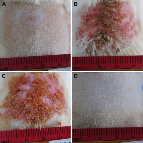 Figure 5 Photographic images of the skin at 14 days after daily treatment.Notes: Rat skin at 14 days after the daily treatment of 4 cm2 dorsal skin of rats daily with 200 µL of (A) distilled water, (B) 0.1% w/v RA or 0.0033 mmol/mL, (C) 0.0033 mmol/mL retinal, and (D) PRN (at the concentration corresponding to 0.0033 mmol/mL of retinal).Abbreviations: PRN, proretinal nanoparticles; RA, retinoic acid.