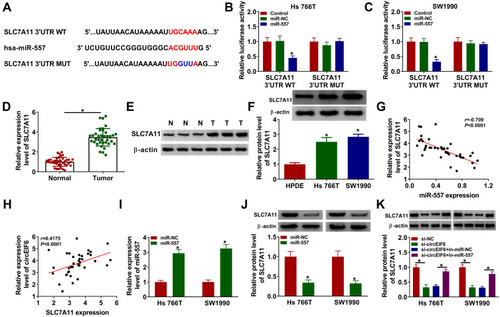 Figure 5 SLC7A11 is a target of miR-557 in pancreatic cancer cells. (A) The interacted mRNAs of miR-557 were predicted through using bioinformatic software (TargetScan), and SLC7A11 was predicted to interact with miR-557 via its “UGCAAA” sequence. (B and C) The target interaction between miR-557 and SLC7A11was verified by dual-luciferase reporter assay. (D and E) qRT-PCR and Western blot assay were conducted to determine the mRNA and protein expression of SLC7A11 in pancreatic tumor tissues and adjacent normal tissues. (F) Evaluation of SLC7A11 level in HPDE, Hs 766T and SW1990 was conducted by Western blot assay. (G and H) The linear relationship between SLC7A11 and miR-557 or circEIF6 was analyzed by Pearson correlation coefficient. (I) Hs 766T and SW1990 cells were transfected with miR-NC or miR-557, and the level of miR-557 was assessed by qRT-PCR after transfection for 24 hours. (J) Western blot assay was used to analyze the protein expression of SLC7A11 in Hs 766T and SW1990 cells transfected with miR-NC or miR-557. (K) Evaluation of SLC7A11 protein expression in pancreatic cancer cells transfected with si-NC, si-circEIF6, si-EIF6 + in-miR-NC or si-EIF6 + in-miR-557 was conducted by Western blot assay. *P<0.05.