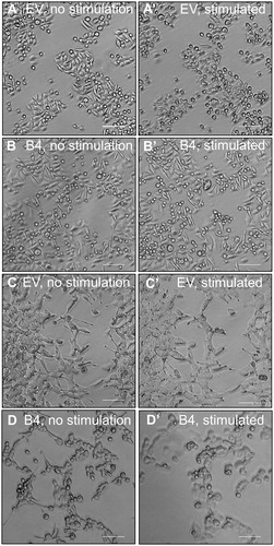 Figure 7. Stimulation of SW480 and LIM2405 cells with EphrinB2-Fc in vitro. (A–A’) SW480 EV cells pre and post-stimulation (respectively). (B–B’) SW480 B4 cells pre and post-stimulation (respectively). C-C’. LIM2405 EV cells pre and post-stimulation (respectively). (D–D’) LIM2405 B4 cells pre and post-stimulation (respectively). (Scale Bars for all 100 µm).