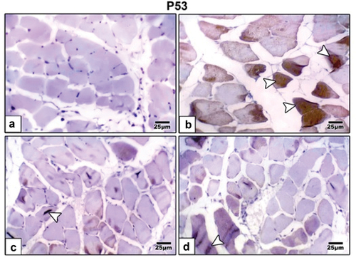 Figure 8. Photomicrographs of formalin fixed histological sections of skeletal muscle fibers immunohistochemical stained with P53 of 21-day-old rat. (a) Control revealed weak immunohistochemical reaction of P53. (b) High fat diet revealed increased dark brown P53 immunohistochemical reaction in muscle fibers manifesting cell death. High fat diet with (c) barley and (d) fenugreek supplementation revealed decreased immunohistochemical reaction of P53. Arrow head indicating immunohistochemical reaction of P53.
